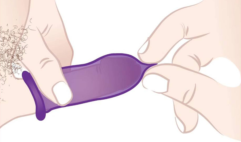 Kuidas kasutada kondoomi - kuidas kondoom paigaldada. Kondoom tuleb peenisele rullida. Ühe käe nimetissõrme ja pöidlaga pigista kinni kondoomi otsas olev tühimik ja teise käega rulli kondoom lõpuni välja peenise põhjani. 